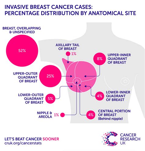 Cancer Of The Breast Statistics More In Cancer A Z