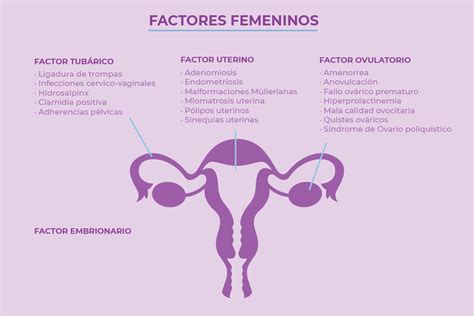 Principales Causas De Infertilidad Femenina Crea Clínica De