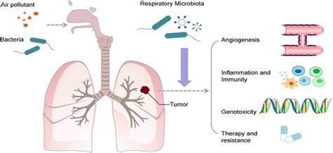 The Role Of Respiratory Microbiota In Lung Cancer