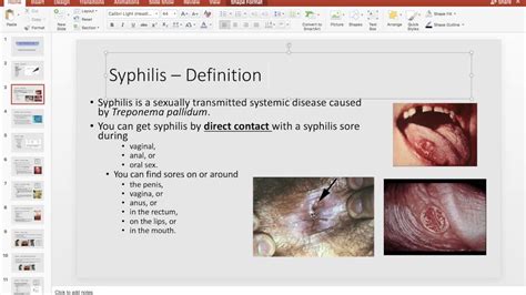 Syphilis Definition Stages And Complications Part 1 Of 5 Youtube