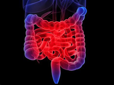 The Pathophysiology Of Inflammatory Bowel Disease Part 1 El Paso