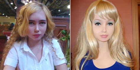 These People Who Had Extreme Plastic Surgery Will Shock You