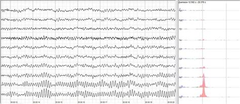 Alpha Wave Alchetron The Free Social Encyclopedia