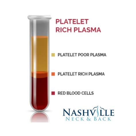 Platelet Rich Plasma Nashville Neck And Back
