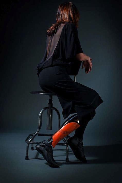 Stylish Custom Made Prosthetic Legs Reflect The Personalities Of Their