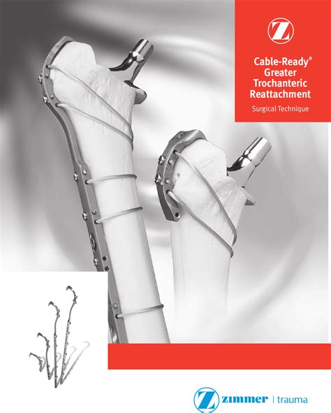 Cable Ready Greater Trochanteric Reattachment Surgical Technique 97