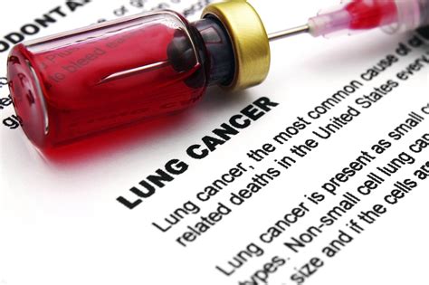 新藥三個月助戒煙 吸煙增肺癌風險 百害無一利