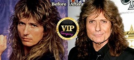 David Coverdale Plastic Surgery Before and After Pictures | David ...