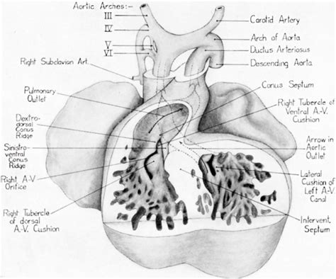 Aorta Truncus Pulmonalis