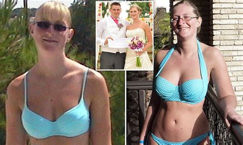 Cheshire Woman Worked Non Stop To Afford 32g Breast Implants In Time