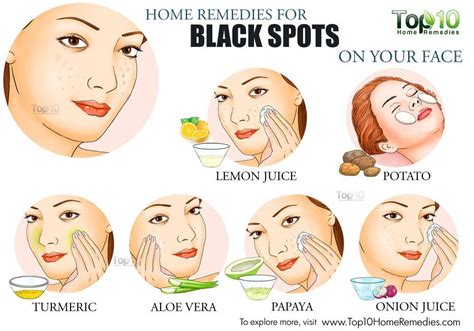 Black Spots On Face Dark Spots Black Marks On Face Brown Spots Face