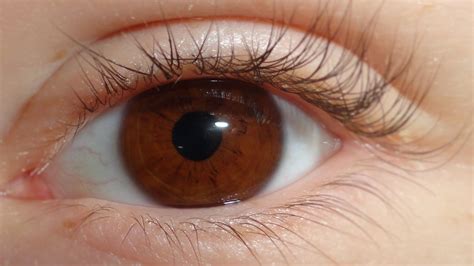 People With Natural Red Eyes