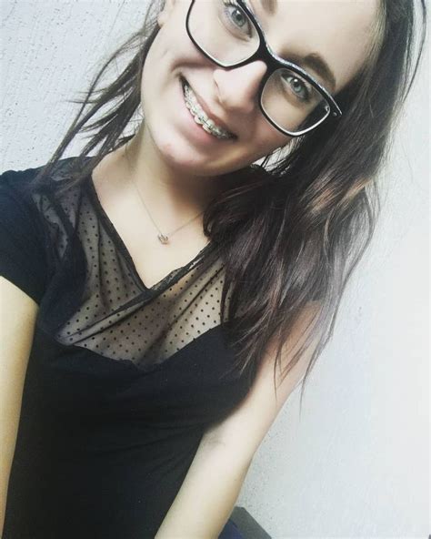 Pin On Braces And Glasses