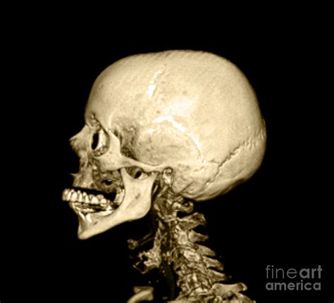 Human Skull Photograph By Medical Body Scans Fine Art America