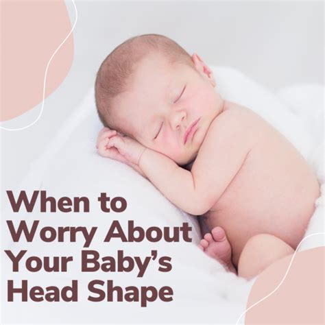 When To Worry About Your Babys Head Shape Noodle Soup