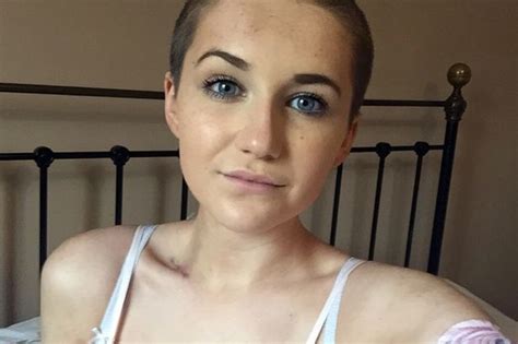 Bald And Proud Cancer Teenager Who Lost All Her Hair Writes Moving