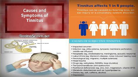 Tinnitus Symptoms Everything You Need To Know About Tinnitus Symptoms