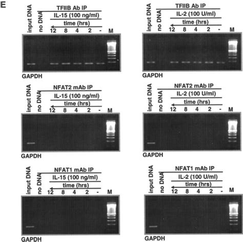 Interleukin Il And Il Reciprocally Regulate Expression Of The