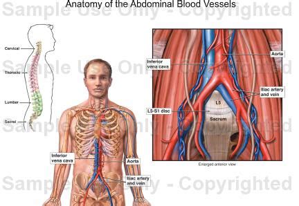 For example, new capillaries permeate the muscles of a conditioned athlete. Anatomy of the Abdominal Blood Vessels - Medical ...