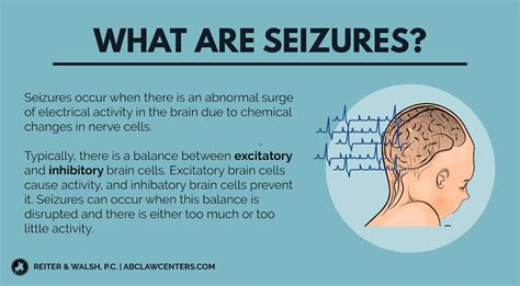 Seizures Occur When There Is An Abnormal Surge Of Electrical Activity
