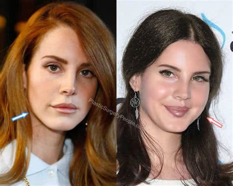 Lana Del Rey Before And After 2019