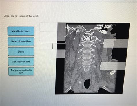 Label The Ct Scan Of The Neck Answerdata