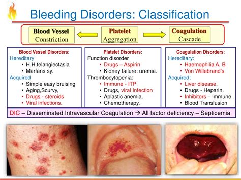 Ppt Haematology For Dental Students Bleeding Disorders Powerpoint