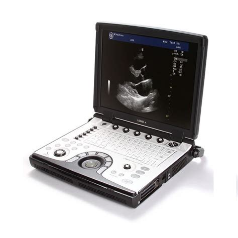 Ge Logiq E Ultrasound Machine Prices And Specs Ultrasound Supply