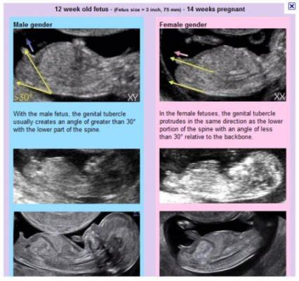 Home general health how often should you bathe a newborn? How to Find Out Your Baby's Gender - The Nub Theory ...