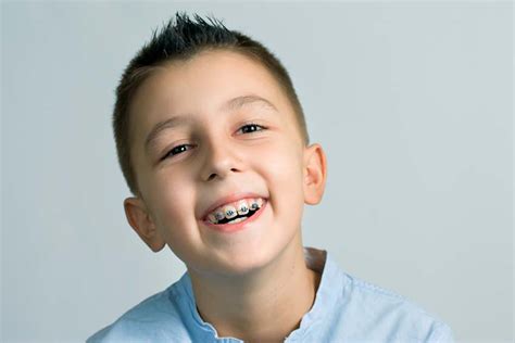 How Much Do Braces Cost With Insurance And Without It Victory Plaza