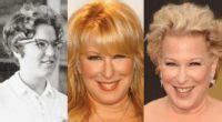 Bette Midler Plastic Surgery Before And After Pictures