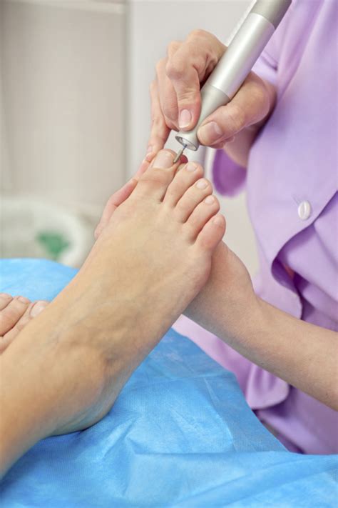 Treatment For Thickened Toenails Well Heeled Podiatry Melbourne