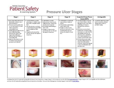 Stage Pressure Ulcer Nursing Care Plan