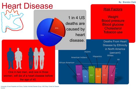 Infographic Us Heart Disease Statistics Sli