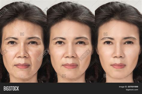 Anti Aging Process Image And Photo Free Trial Bigstock