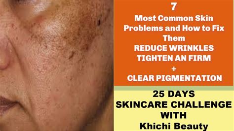 7 Most Common Skin Problems And How To Fix Them Youtube