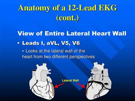 Ppt 12 Lead Ekg 101 Powerpoint Presentation Free Download Id3223309