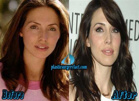 Whitney Cummings Plastic Surgery Before And After Pictures Plastic
