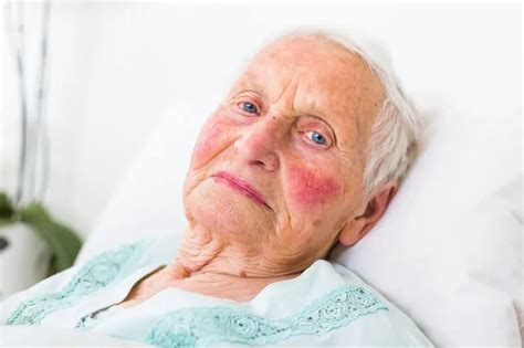 Bed Sores An Almost Completely Avoidable Deadly Nursing Home Complication