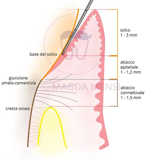 Parodontologia Dottssa Magda Mensi