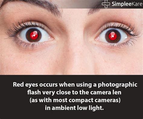 Ever You Wonder What Causes Red Eyes In Photos Here Is The Answer