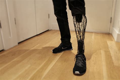 The Exo Prosthetic Leg Prototype 3d Printing Industry