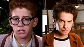 Seth Green Got Plastic Surgery to Change His Nose?