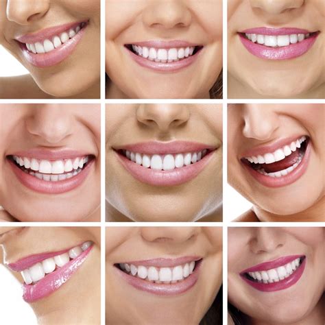 How Does A Patient Know What Will Look Good In Cosmetic Dentistry