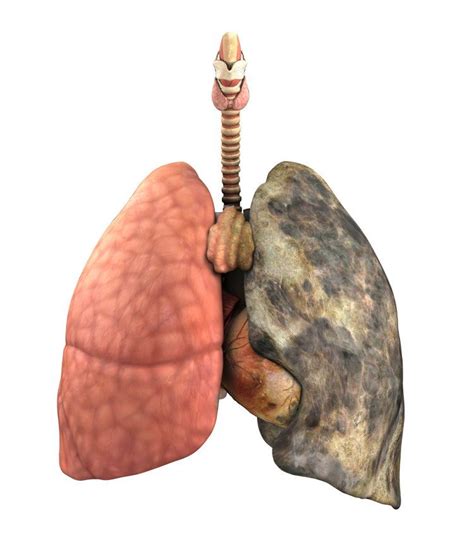 Mucus Filling Up Lungs