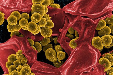 Micrograph Of Methicillin Resistant Staphylococcus Aureus Mrsa Edited 2