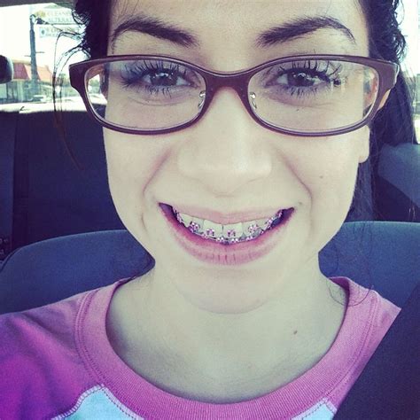 Braces Glasses 2014