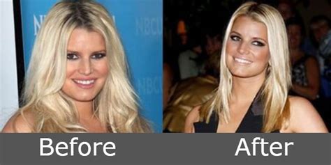 Jessica Simpson Weight Loss 2024 Lost 100 Pounds