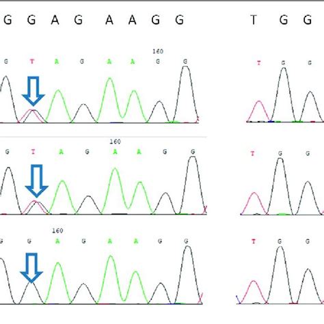 Sanger Sequencing Validation Of The Ttc7a Variants Download Scientific Diagram