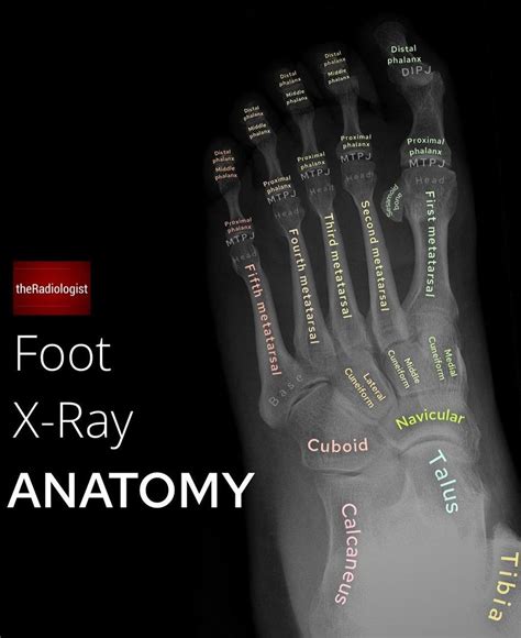 Foot X Ray Anatomy Medizzy